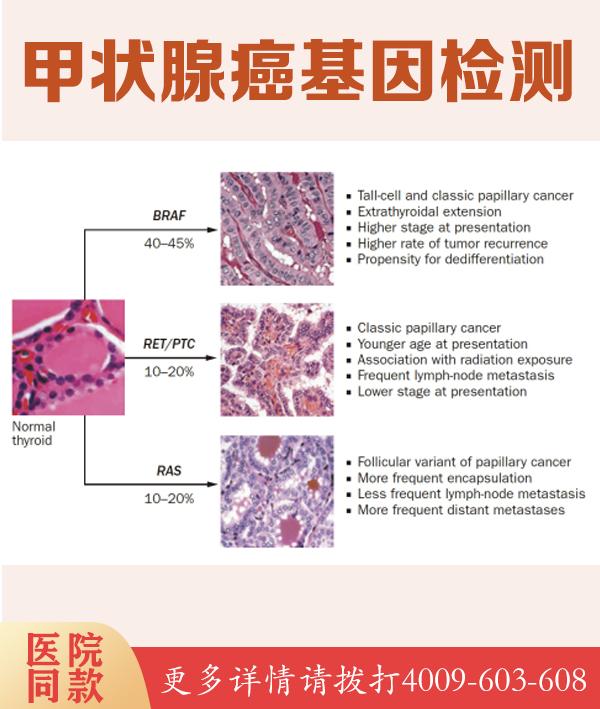 解码生命密码 太原华云基因检测中心人体基因诊断详解